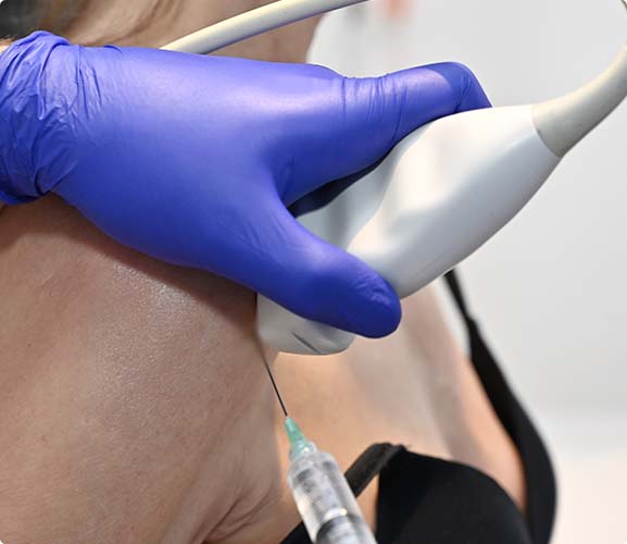 영상유도하시술